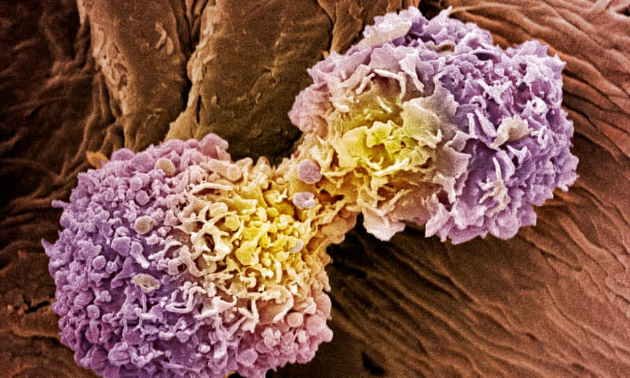 Scientists develop 10-minute universal cancer test